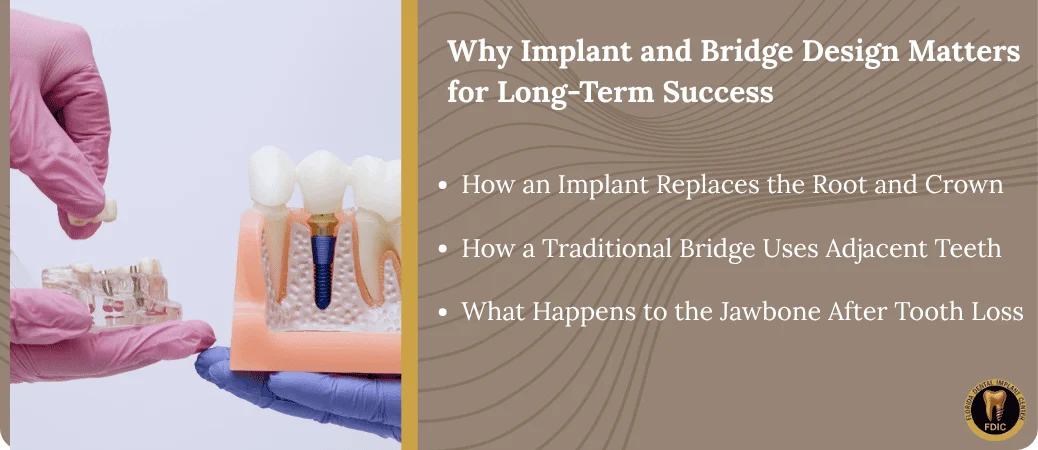 Why Implant and Bridge Design Changes Long Term Results