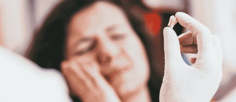 signs you need a tooth extraction